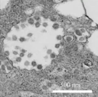 Covid-virus